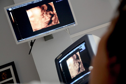Ultrasound displays of a fetus in a hospital room