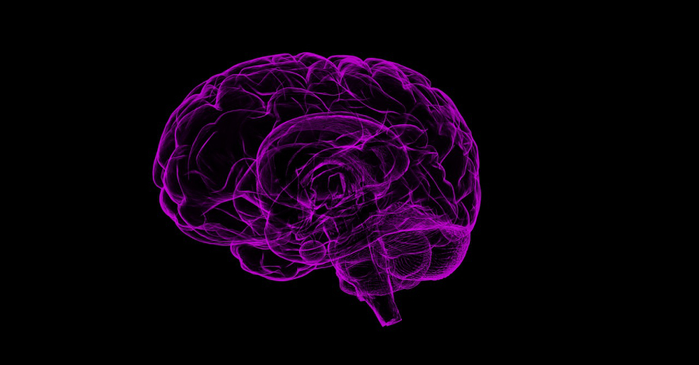 Purple outline scan of a brain