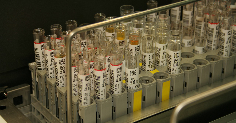 Medical test of urine samples