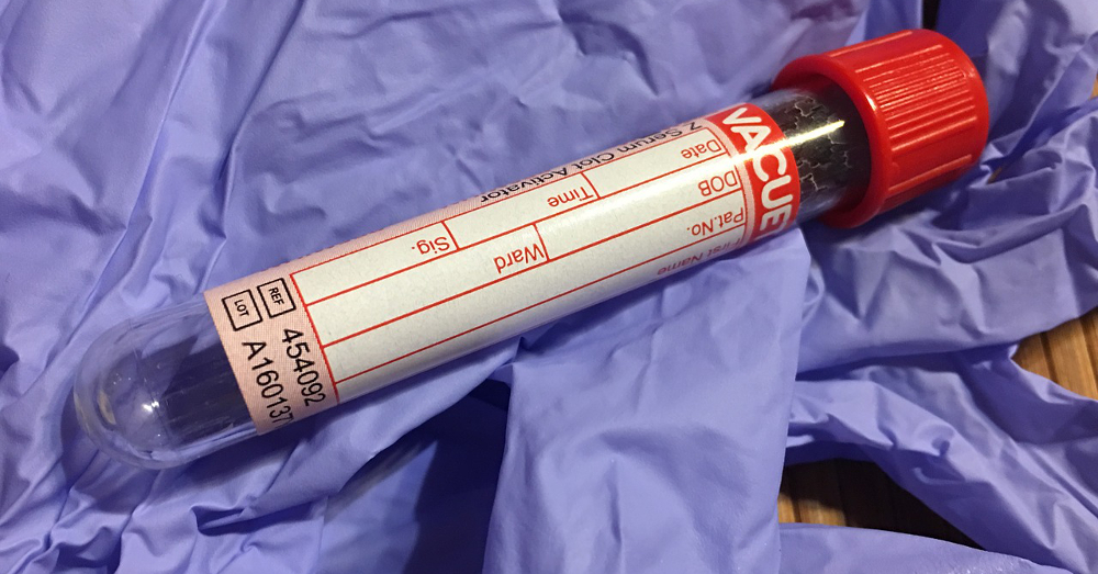 Blood testing tube on top of purple latex exam gloves