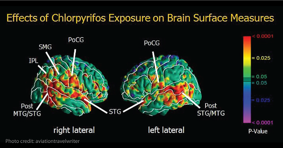 Brain exposure to pesticides.