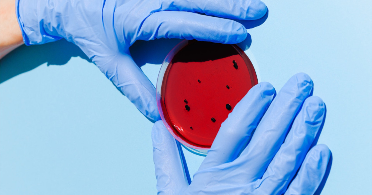 red petri dish with growing specimen being held by a scientist with blue rubber gloves